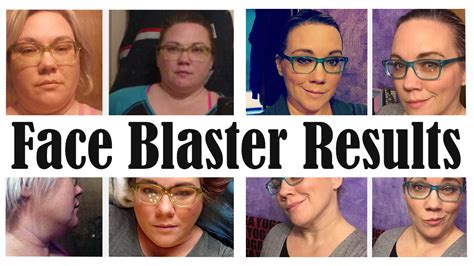 face blasters