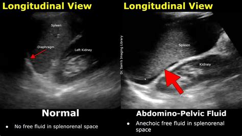 fast scan | HP Universal Scan Software Software and Driver