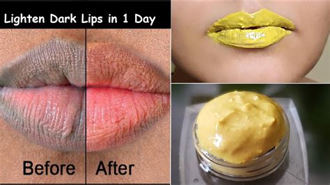 fastest way to lighten dark lips