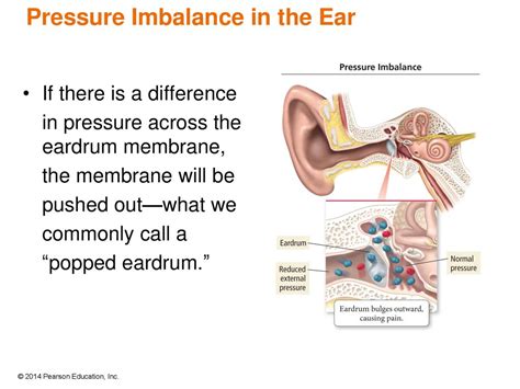 feel pressure in ear when bending over
