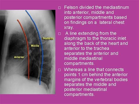 Felson Chest Radiology