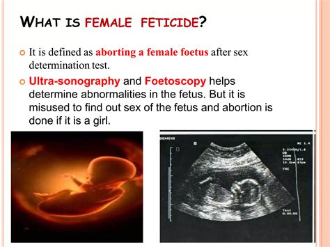 Female Foeticide Meaning