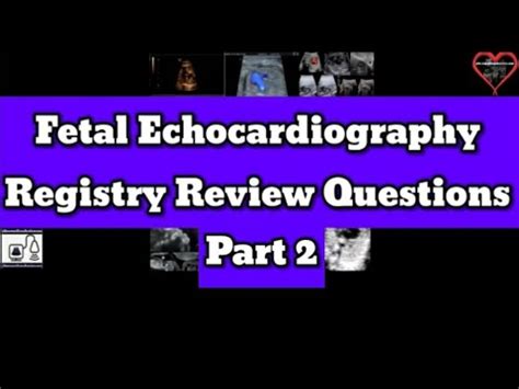 Download Fetal Echocardiography Review 