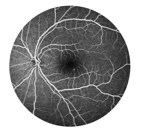 Ffa Eye Test