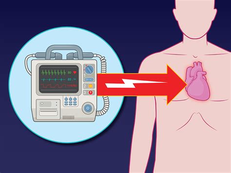 Fibrillation And Defibrillation