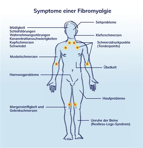 fibromyalgie