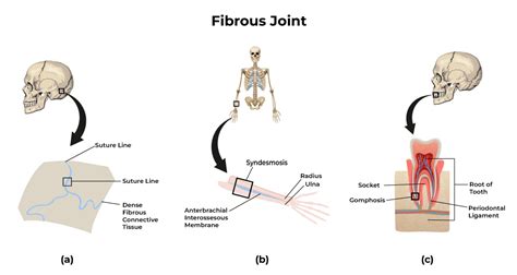 Fibrous Joint Example