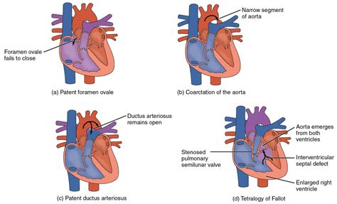 Read Online Field Guide Heart Defects 