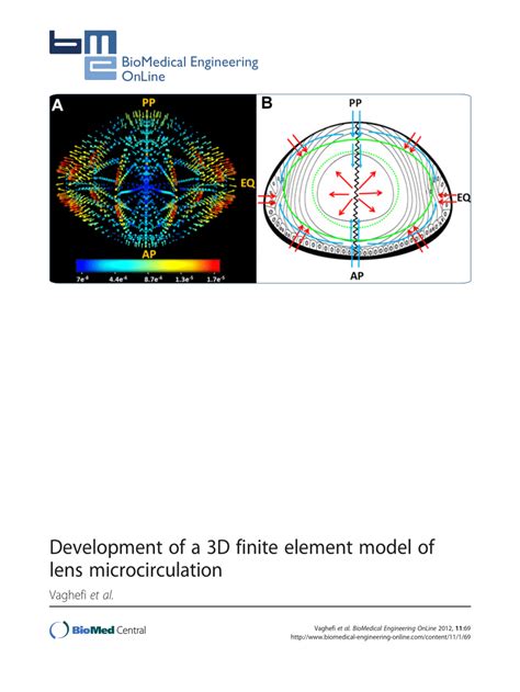 Finite Element Modeling Of Lens Deposition Using Sysweld