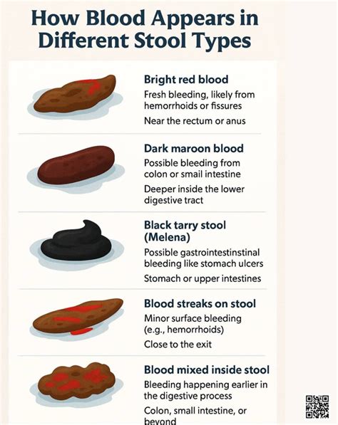 fissure blood in stool