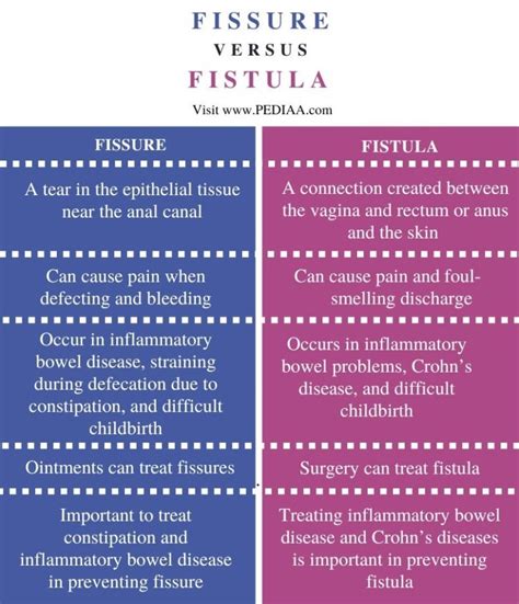 Fissure Vs Fistula