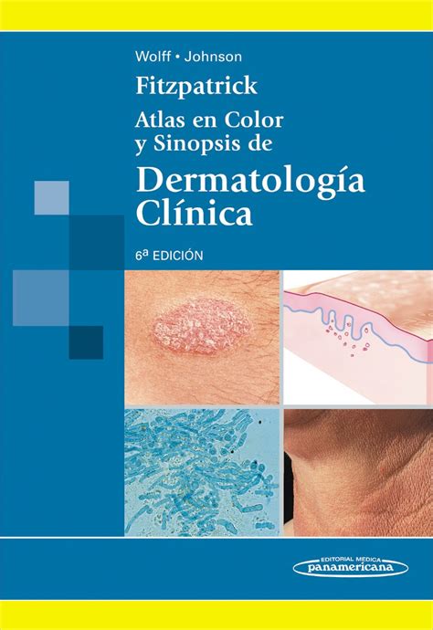 fitzpatrick dermatologia