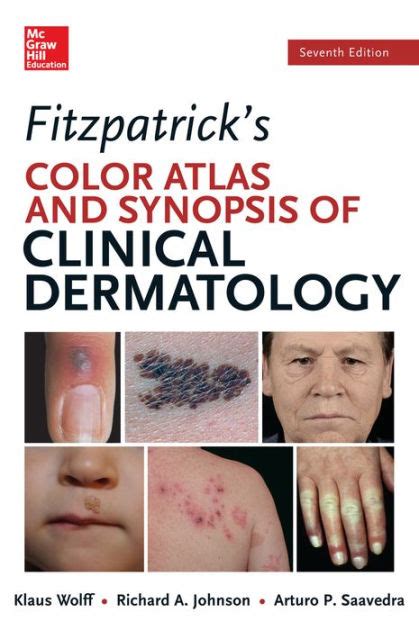 Read Online Fitzpatrick Color Atlas Synopsis Dermatology 7Th Edition 