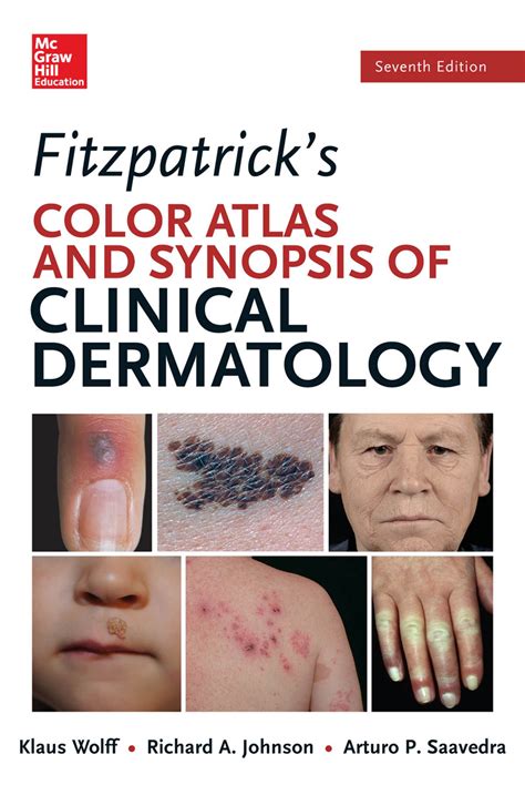 Read Online Fitzpatrick Color Atlas Synopsis Dermatology 7Th Edition 