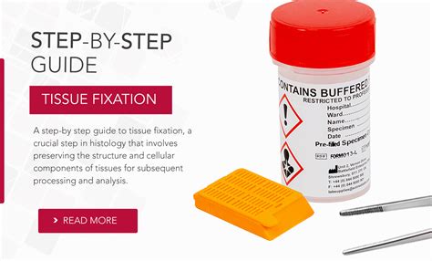 fixation