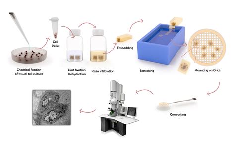 fixation for electron microscopy