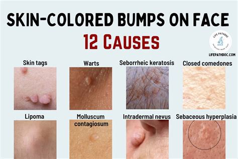 flesh colored