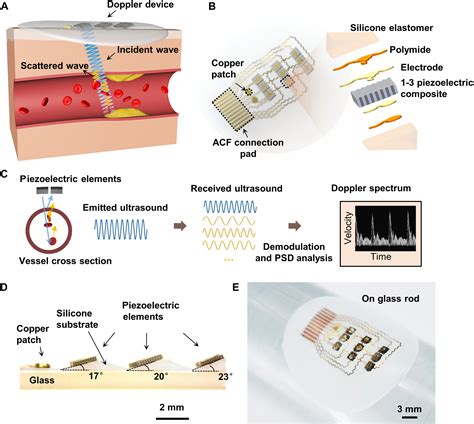 Flexible Doppler Ultrasound Device For The Monitoring Of Blood Flow Science - Blood Flow Science