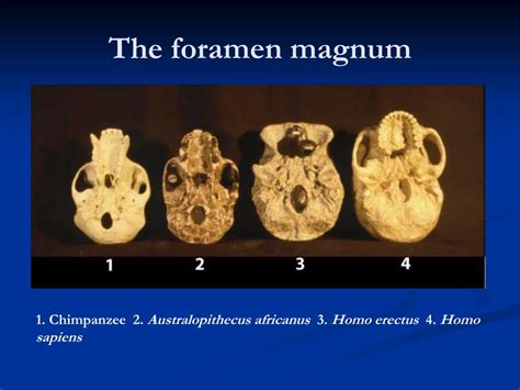 foramen magnum evolution