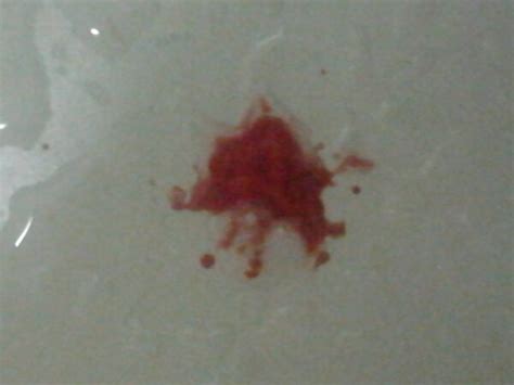 foto muntah darah
