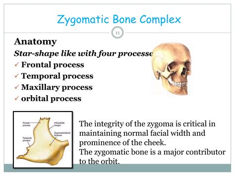 Fracture Of Zygomatic Complex