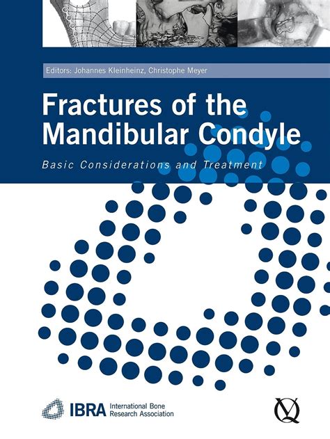 Download Fractures Of The Mandibular Condyle Basic Considerations And Treatment 