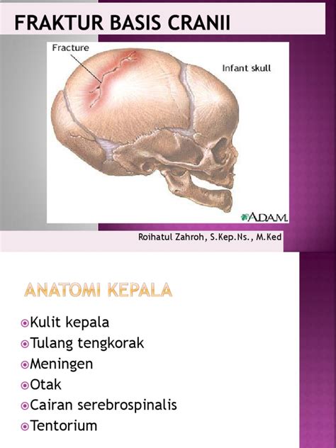 fraktur basis cranii | Manifestasi Klinis dan Pilihan Terapi pada Fraktur