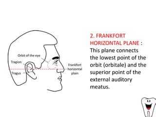 Frankfort Horizontal Plane