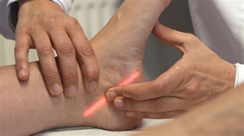 fuss taub schlaganfall