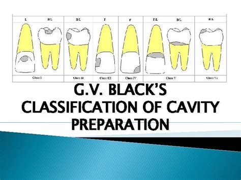 G V Blacks Work On Operative Dentistry With Which His Special Dental Pathology Is Combined Vol 1 4 Volume1 Pathology