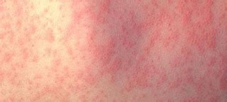 gabakan | Kp billigt Alprazolam Bestlla Alprazolam online Biker