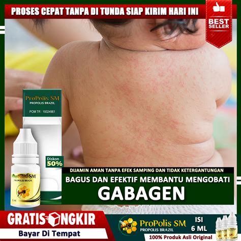gabaken | Gabagen Mau tanya nih bunda2 anak saya