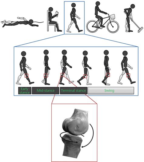 Full Download Gait Parameters Of Patients With Osteoarthritis Of The 