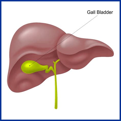 Gall Bladder An Overview Of Cholecystectomy Cholecystectomyknow Itrule It