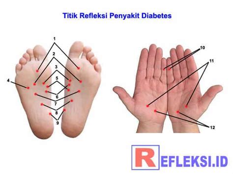 Ciri-Ciri Diabetes Tahap Awal: Kenali Tanda dan Gejala Sedini