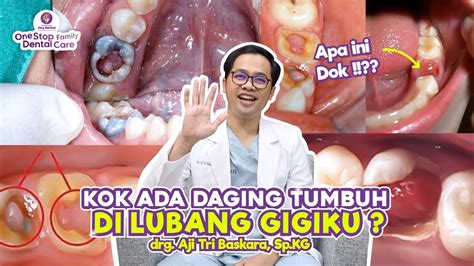 GAMBAR DAGING TUMBUH - Tumbuhan Gymnospermae: Pengertian, Ciri, Klasifikasi