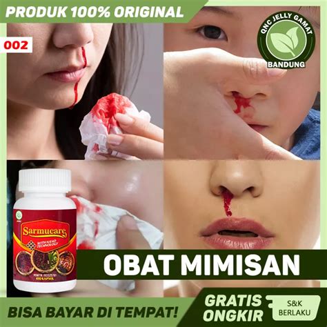 GAMBAR MIMISAN ASLI - Mimisan Stok Foto, Mimisan Gambar Bebas Royalti