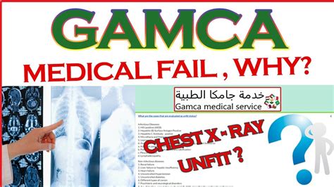 Gamca Test List