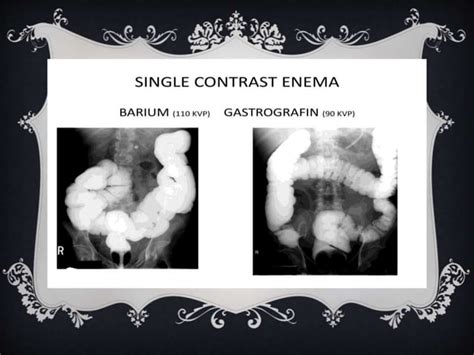Full Download Gastrografin Enema Manual Guide 