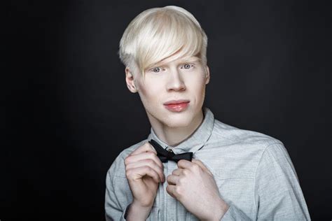2024 gay albino porn