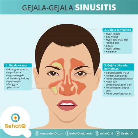 gejala sinusitis