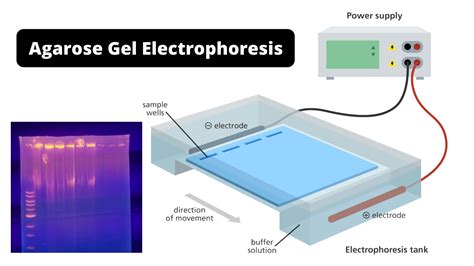 gel electrophoresis 원리