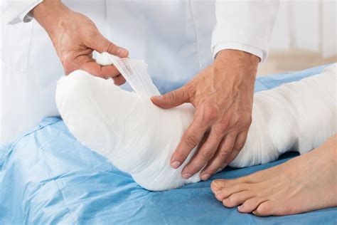gips adalah | PDF