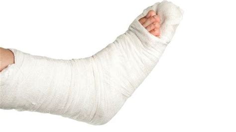 gips behandling