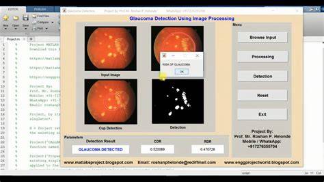 glaucoma detection matlab code