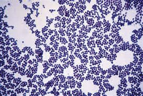 Gram Cocci In Clusters
