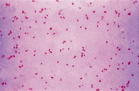 Gram Negative Cocci