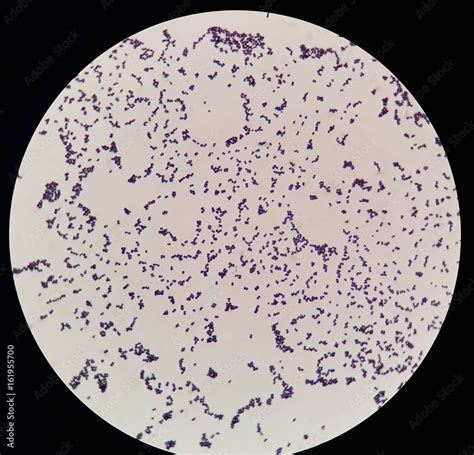 Gram Positive Diplococci