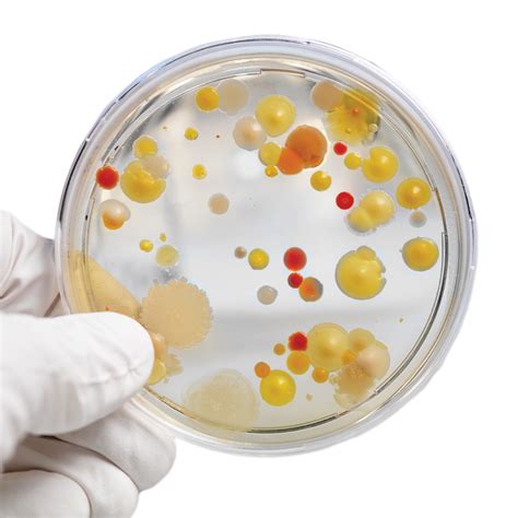Growing Bacteria In Petri Dishes Biology Experiment Petri Dish Science Experiment - Petri Dish Science Experiment