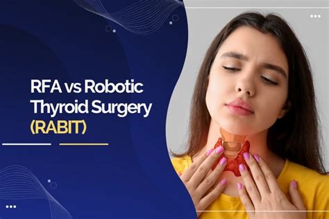 Read Guide To 83 Rabit 